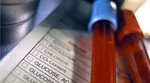 Genska terapija hemofilije pokazuje prve rezultate