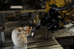 Roboti će biti od velike pomoći u neurokirurgiji