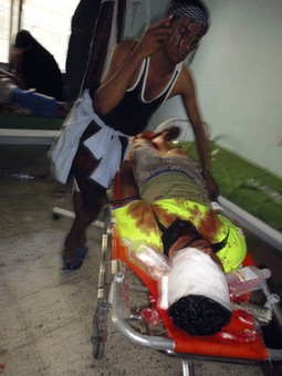 Fotografija ranjenog prosvjednika iz jemenskog grada Taiza (Reuters)