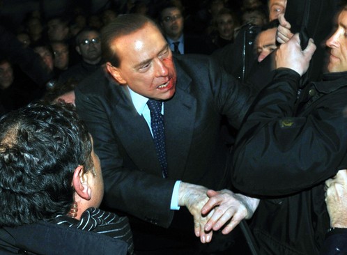 Silvio Berlusconi neposredno nakon napada