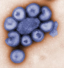 OPASAN VIRUS svinjske gripe,
od koje je u Meksiku u zadnjih
tjedan dana umrlo stotinjak ljudi,
počeo se širiti i na druge zemlje, pa i
kontinente