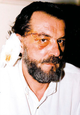VUK DRAŠKOVIĆ, šef Srpskog pokreta obnove, 2000. godine u Budvi je preživio atentat – jedan metak okrznuo mu je uho, a drugi sljepoočnicu