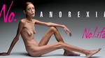 Anoreksija: Novi modni trend ili psihički ventil za mlade