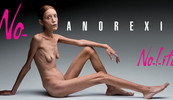 27-godišnja francuska glumica Isabelle Caro ima samo 31 kilogram, a na snimanje je pristala da upozori djevojke na opasnost od anoreksije
