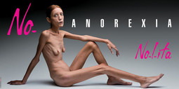 27-godišnja francuska glumica Isabelle Caro ima samo 31 kilogram, a na snimanje je pristala da upozori djevojke na opasnost od anoreksije