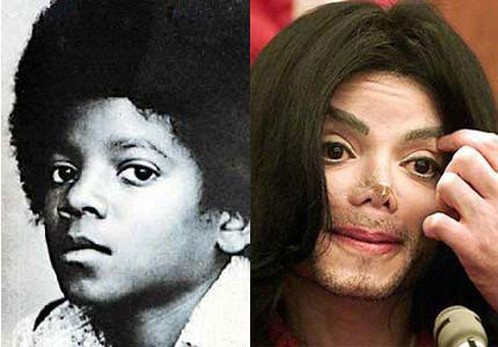 Michael Jackson prije i poslije estetskih zahvata