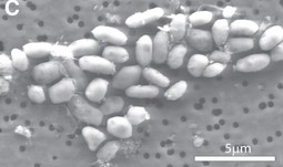 Bakterija GFAJ-1A koja je zamijenila fosfor arsenom u svom DNA